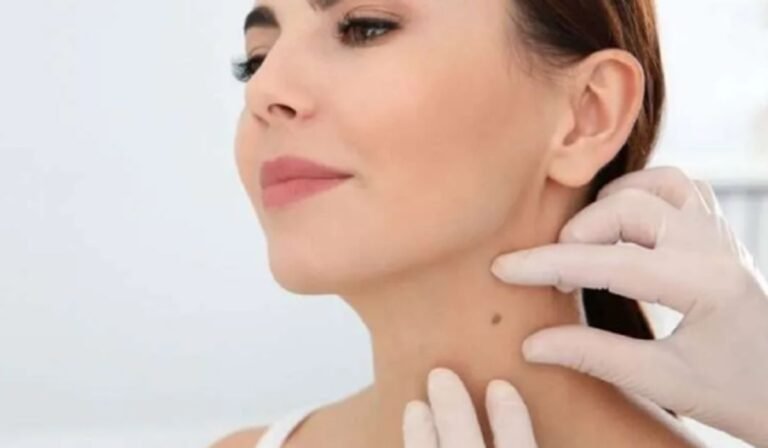 Skin Tag Treatment at Home vs. Clinic: Which Is Better?