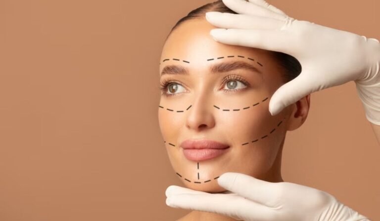 Celebrity-Inspired Facial Rejuvenation Trends and the Popularity of Deep Plane Facelifts